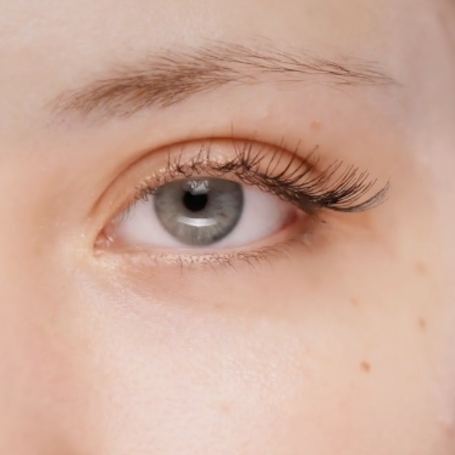 dry eye video preview