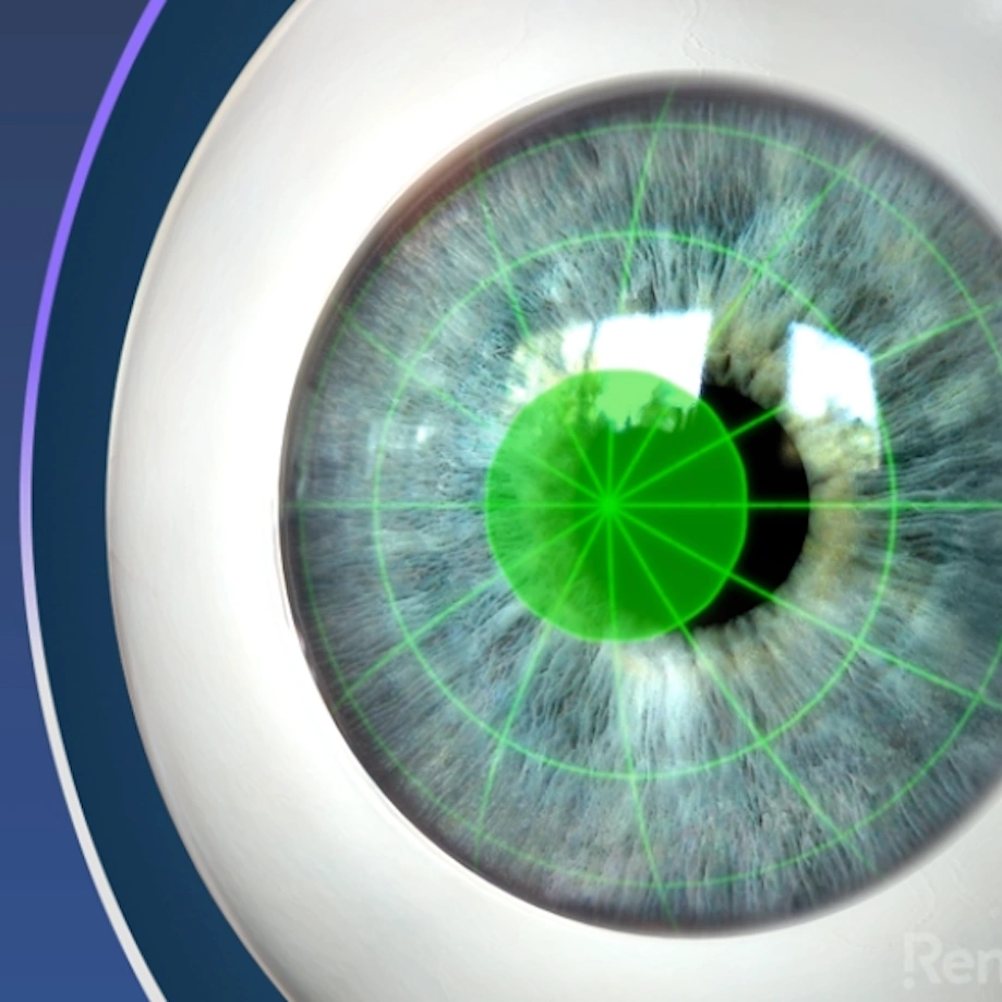 lasik video preview